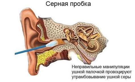 Что такое серные пробки и как они формируются?