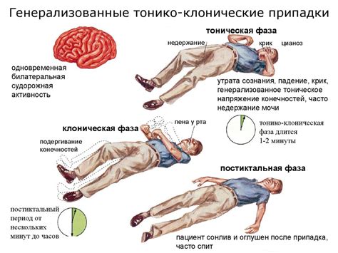 Что такое эпилепсия и как достичь эффективных результатов в ее лечении у взрослых?