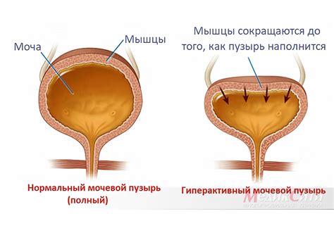  Влияние на работу почечной и мочевого пузыря 