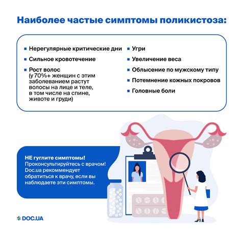  Возможность беременности при синдроме поликистозных яичников через оказание воздействия на игнорируемую систему женского организма