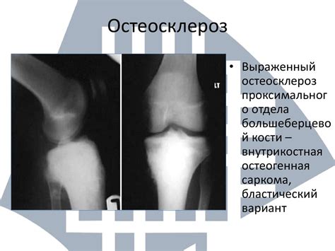  Исследования, подтверждающие укрепление поврежденной структуры костей 