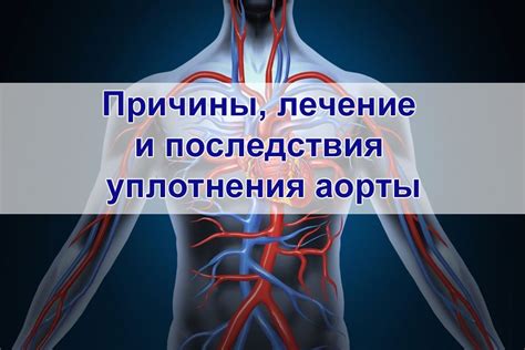  Лечение и профилактика уплотнения клапанов аорты: важность оказания медицинской помощи и меры, предотвращающие развитие данного состояния 