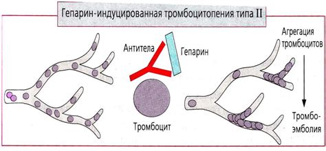  Побочные эффекты гепарина 