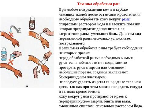  Правильная обработка раны для предотвращения инфекционных осложнений и неустановившейся длительной кровотечи 