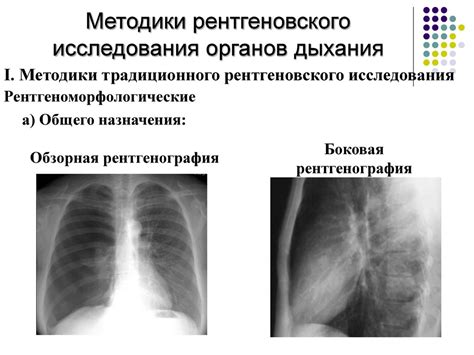  Преимущества метода рентгеновского исследования органов дыхания 