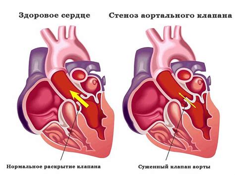  Состав и функции створок аортального клапана в структуре аорты 