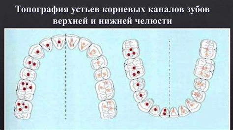  Способы исключения аномалий в верхней полости челюсти 